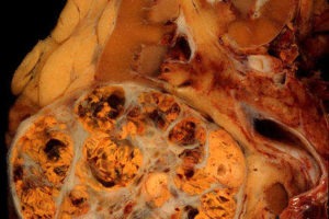 Pharmacuetical Business review