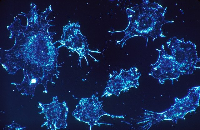 cancer-cells-541954_640 (3)