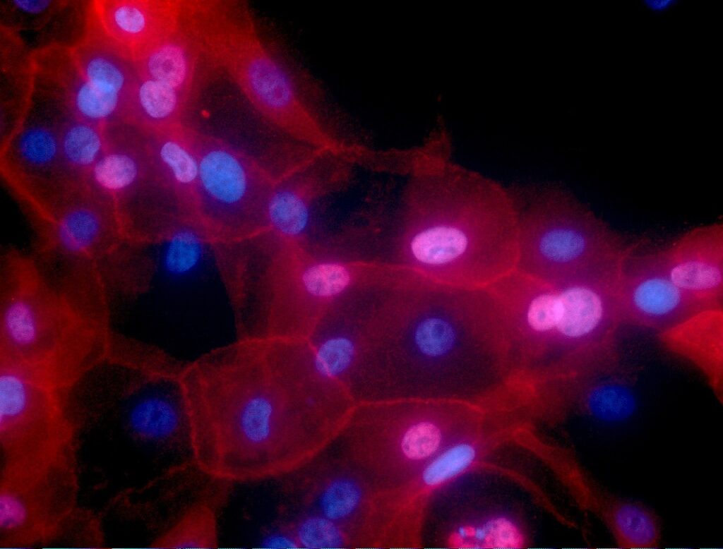 US FDA grants priority review to AstraZeneca’s sNDA for breast cancer therapy