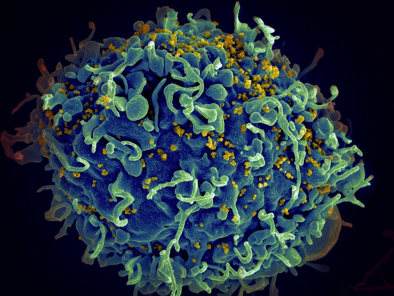 FDA declines to grant approval for Gilead Sciences' HIV treatment - Vimarsana News