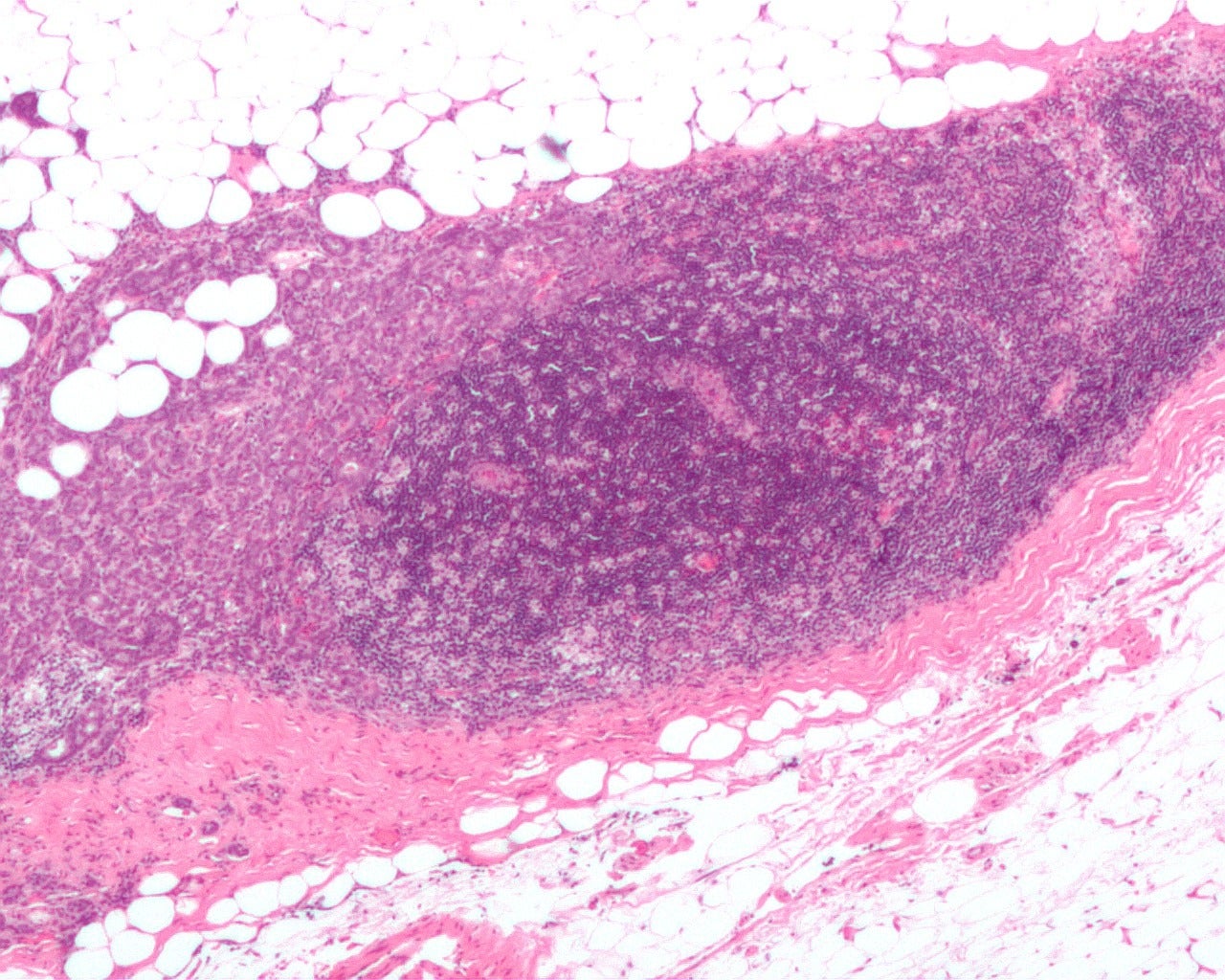 FDA grants fast track designation for Kintara's breast cancer therapy - Vimarsana News