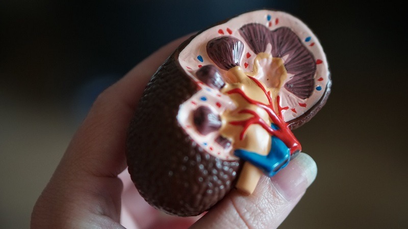Kidney model