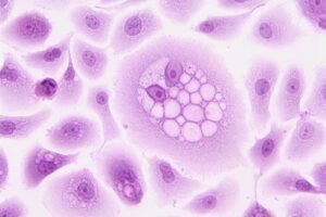 Purple Biotech signs agreement to acquire Immunorizon