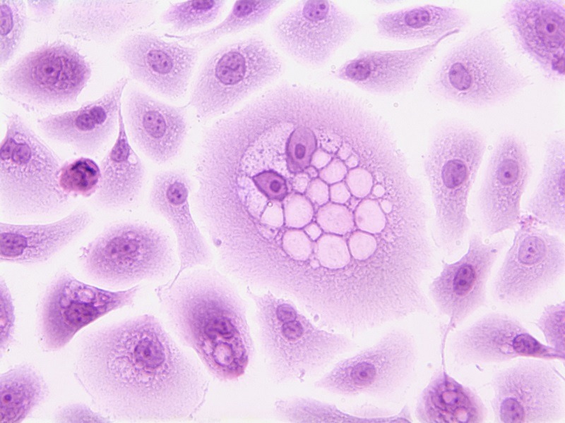 Purple Biotech signs agreement to acquire Immunorizon