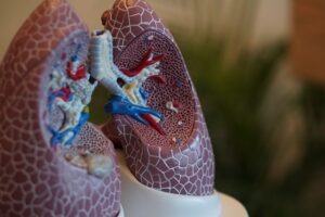 Genprex receives FDA orphan drug designation for lung cancer therapy