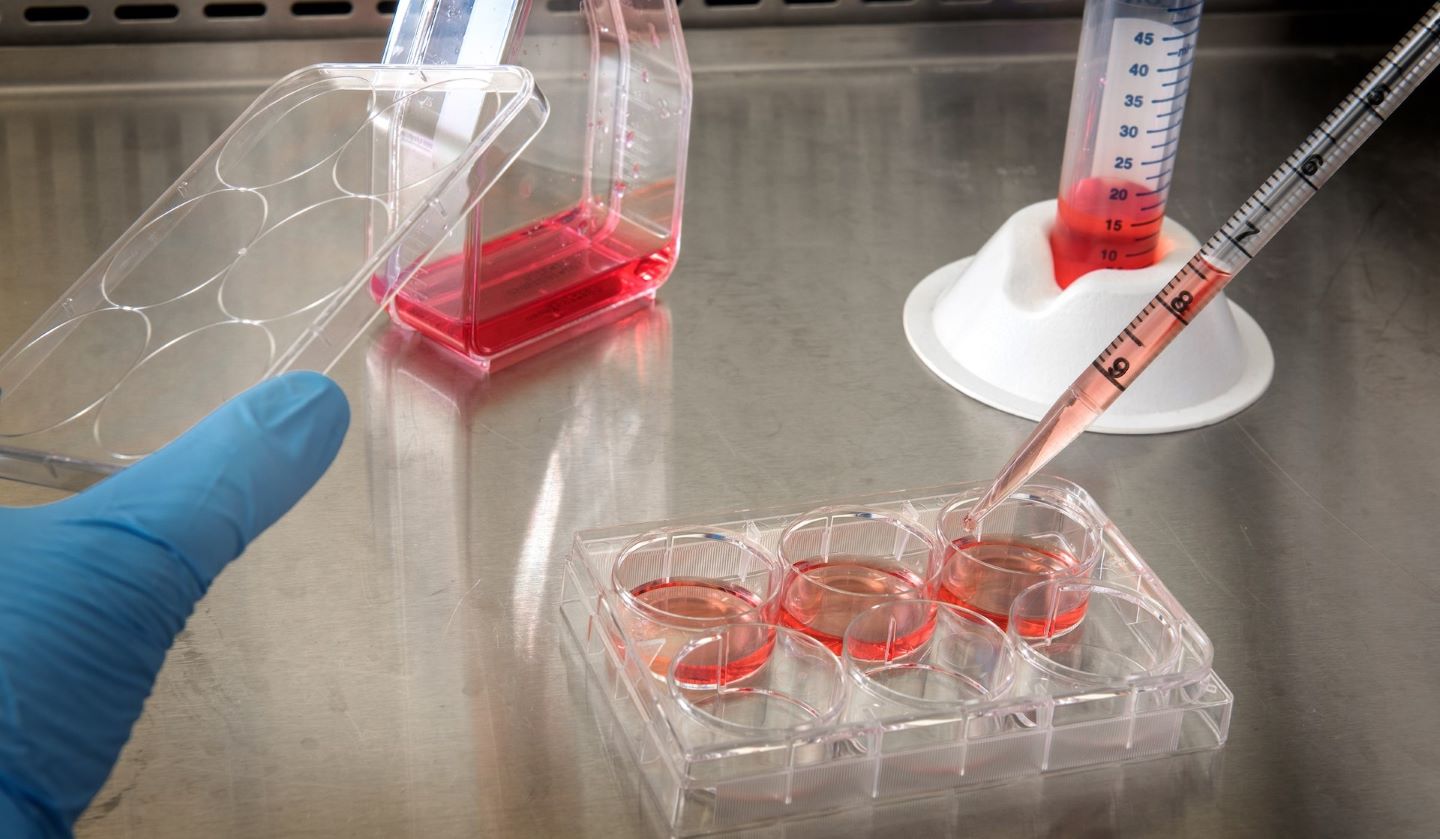 BridgeBio and Resilience partner to develop gene therapies - Vimarsana News