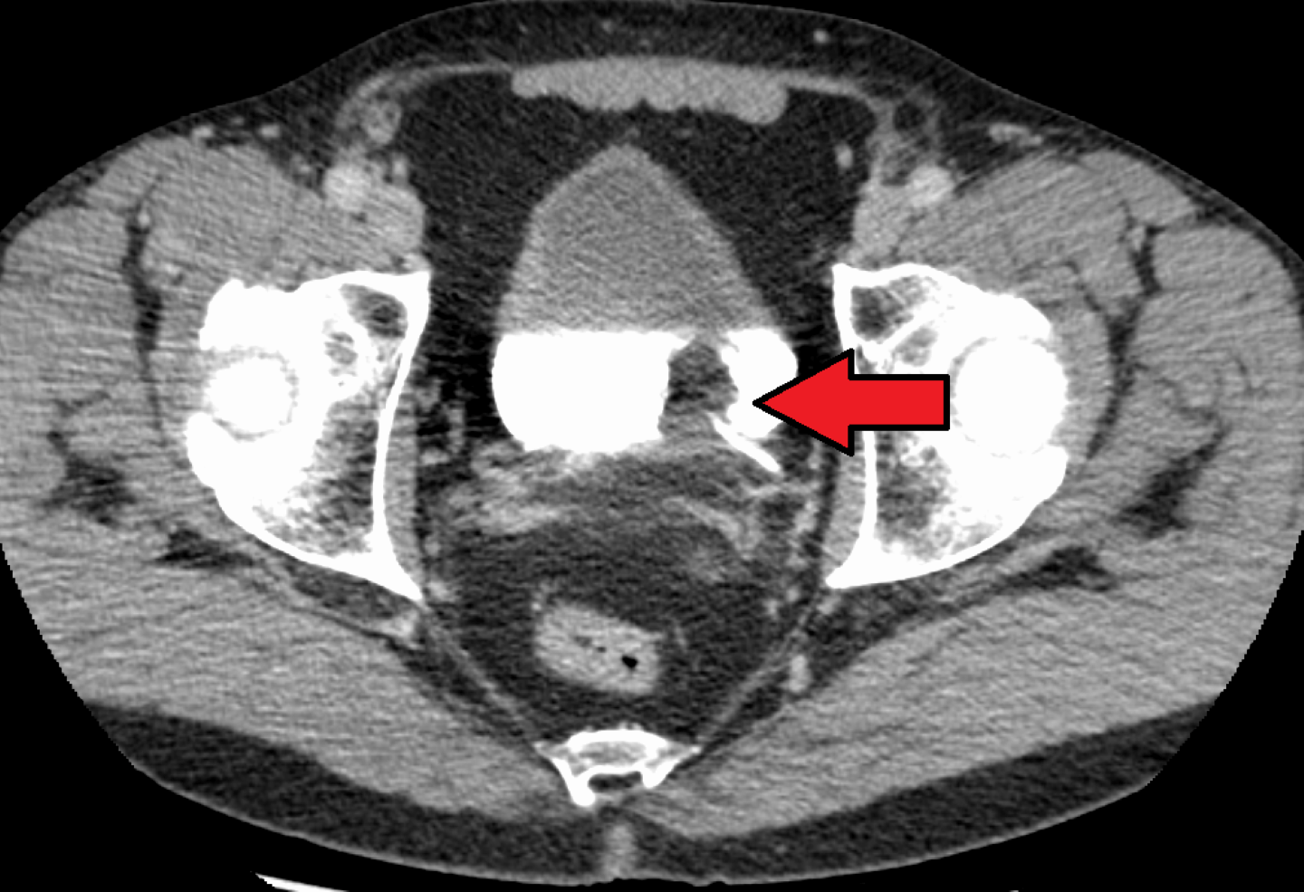 EMA to reciew Pfizer-Astellas' application for bladder cancer therapy - Vimarsana News