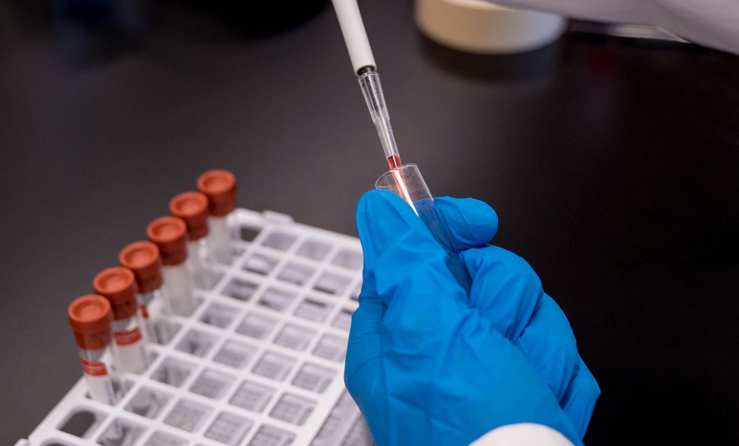 FDA grants fast track status to Artiva's AlloNK for lupus nephritis - Vimarsana News