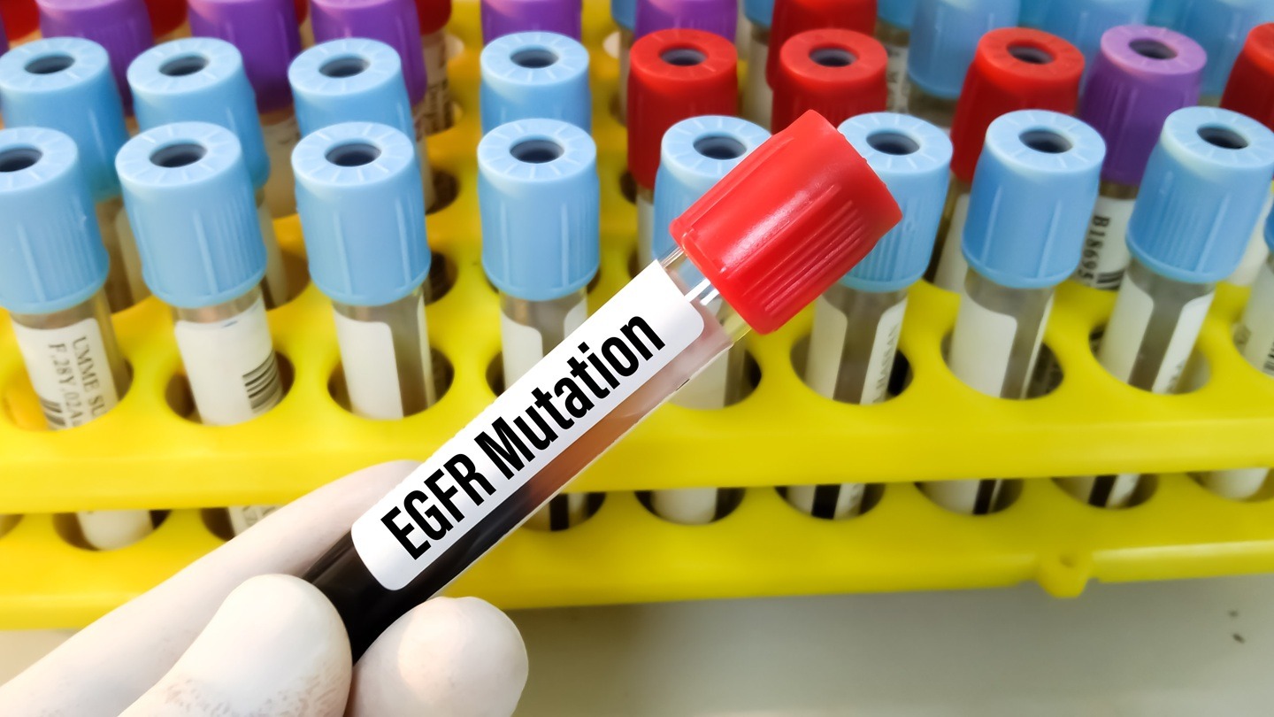 J&J’s Rybrevant Faspro gains FDA approval for new dosing in NSCLC