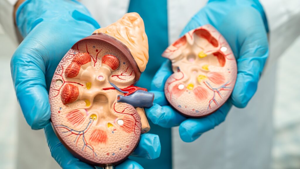 Kidney,Disease,,Chronic,Kidney,Disease,Ckd,,Doctor,With,Human,Model