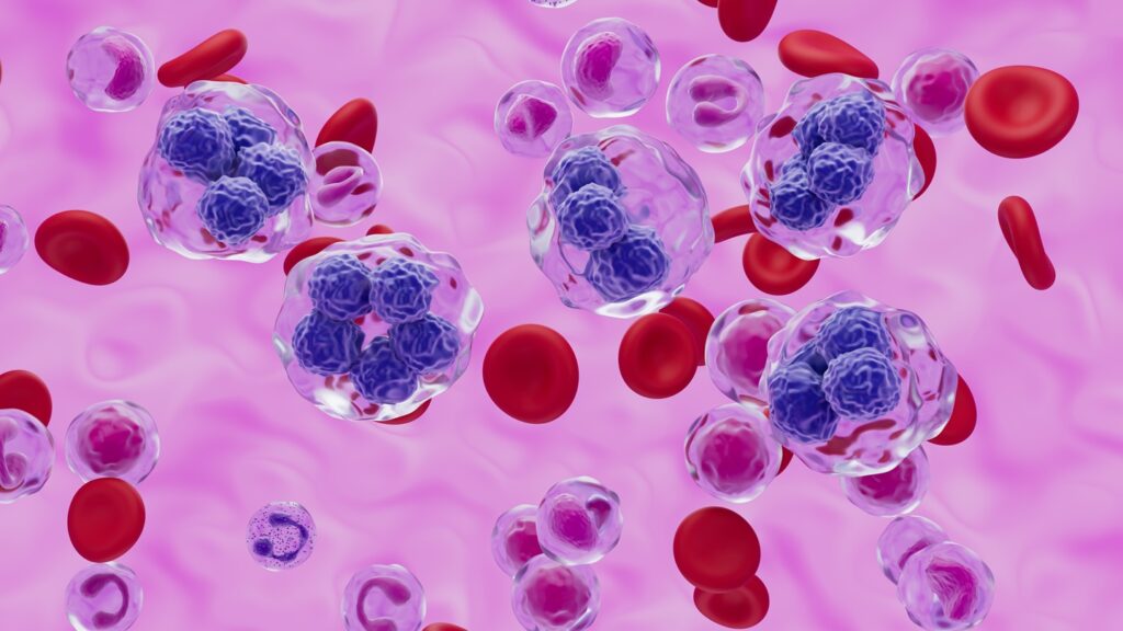 Lymphir is a targeted immunotherapy for relapsed or refractory CTCL. Credit: Nemes Laszlo / Shutterstock.com.