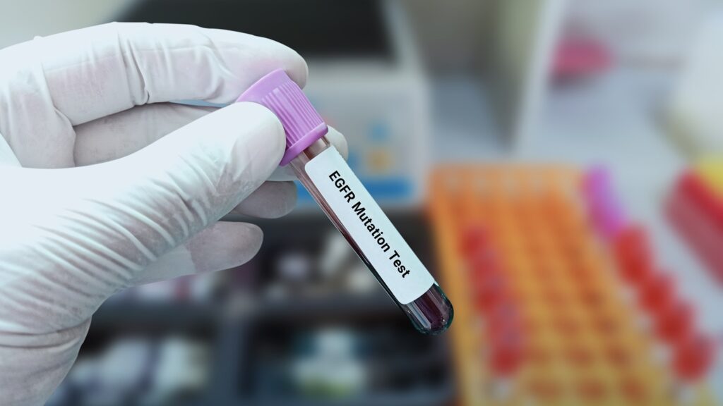 CL-273 targets resistant mutations from EGFR tyrosine kinase inhibitor treatment. Credit: Innovative Creation / Shutterstock.com.