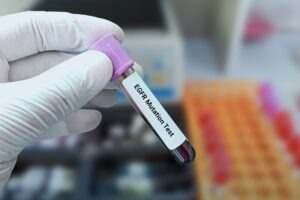 Kairos Pharma signs deal for Celyn Therapeutics’ CL-273