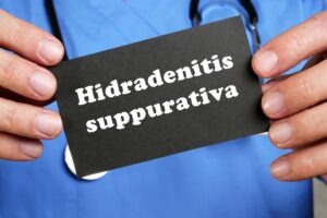 Novartis wins FDA approval for Cosentyx to treat paediatric HS patients