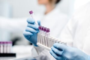 J&J announces Tecvayli-Darzalex combo approval from FDA for multiple myeloma