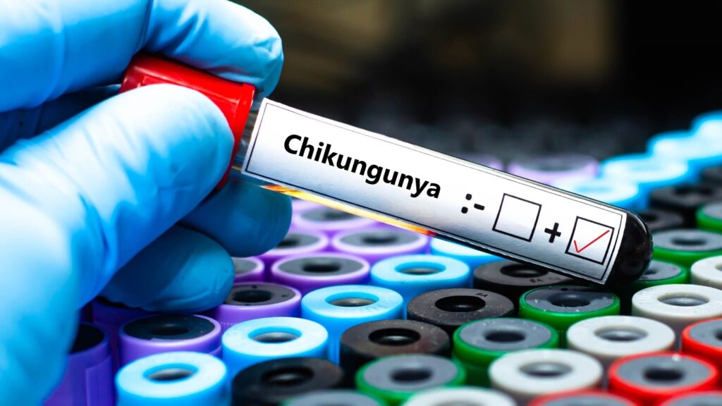 Blood,Sample,Of,Patient,Positive,Test,For,Chikungunya,Virus.
