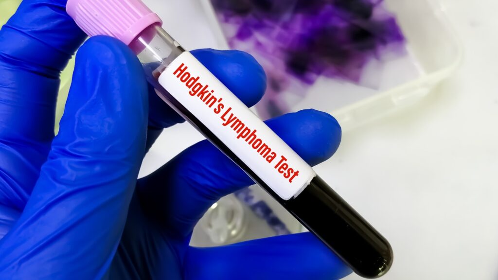 The EC approval is based on the Phase II CheckMate-744 trial in classical Hodgkin Lymphoma patients. Credit: Saiful52 / Shutterstock.com.