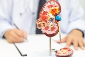 Travere Therapeutics gains FDA approval for sparsentan in FSGS