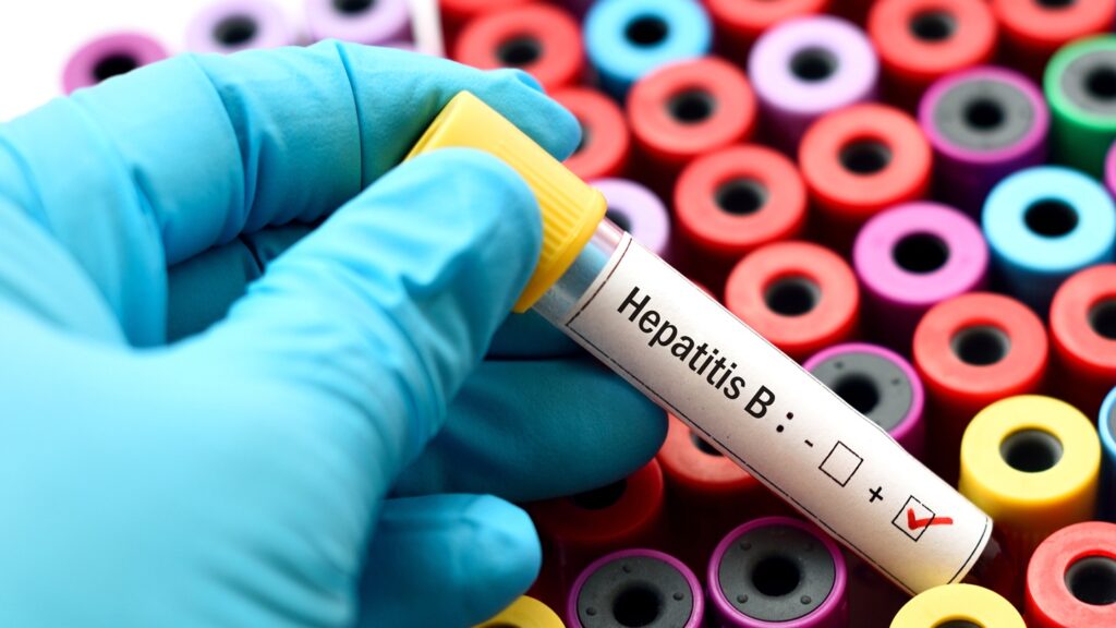 Pevifoscorvir sodium is a potential first-in-class capsid assembly modulator being developed to treat chronic HBV. Credit: Jarun Ontakrai / Shutterstock.com.