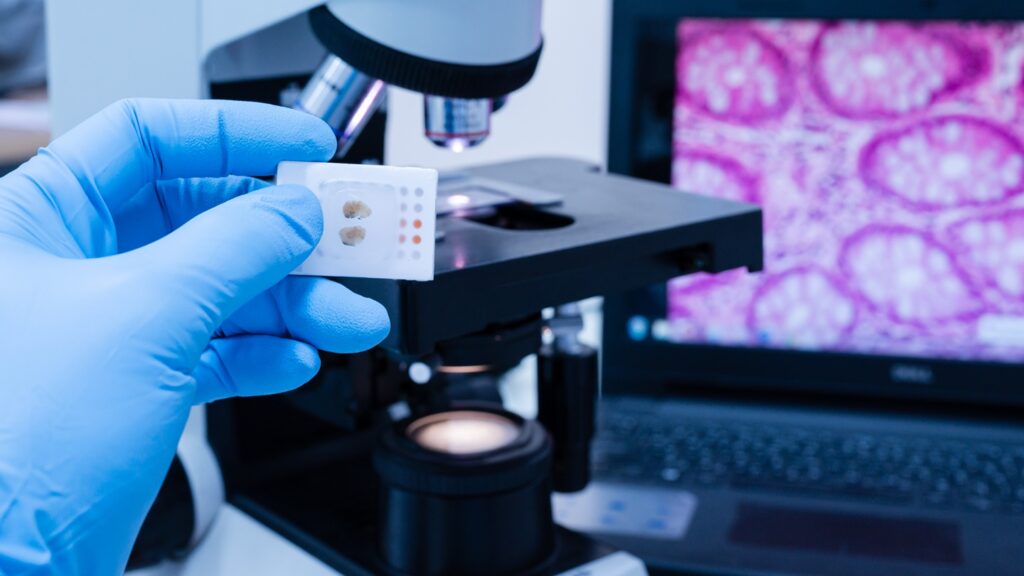 Scientist,Wear,Blue,Glove,Holding,Parafin,Human,Tissue,Block,And