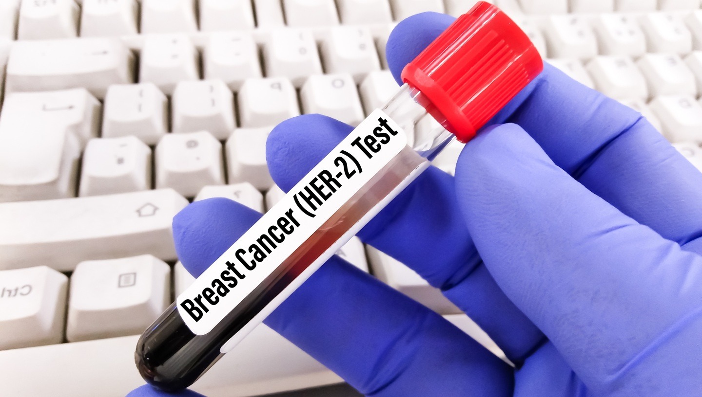 FDA approves Enhertu for two HER2-positive early breast cancer indications