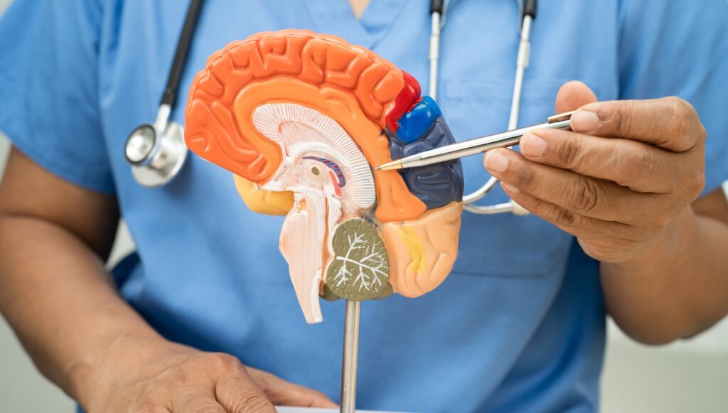 Alzheimer,Disease,,Asian,Doctor,Holding,Brain,Anatomy,Model,For,Study