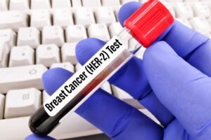 Roche’s giredestrant secures FDA priority review for breast cancer