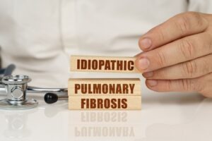 Simcere and Stanford partner to develop IPF therapies