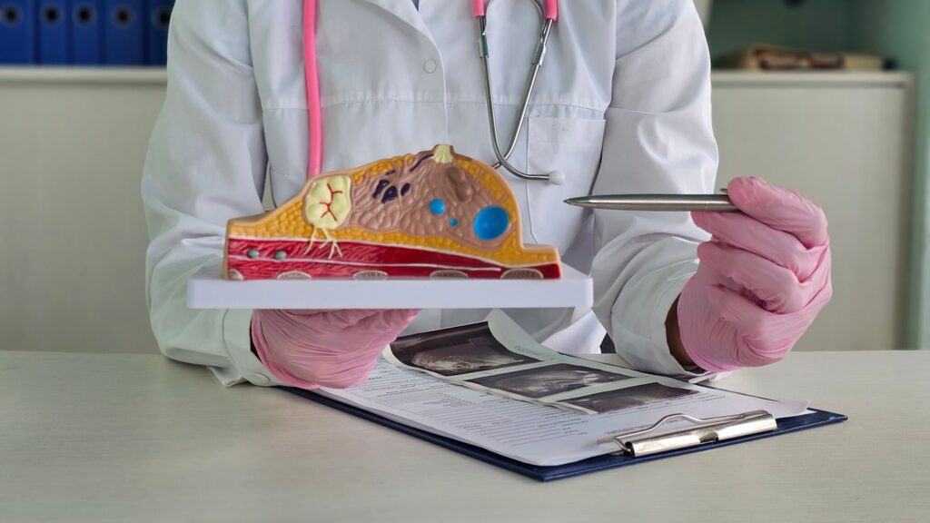 The vaccine targets human α-lactalbumin, a protein associated with lactation that is abnormally expressed in certain types of breast cancer. Credit: NMK-Studio/Shutterstock.com.