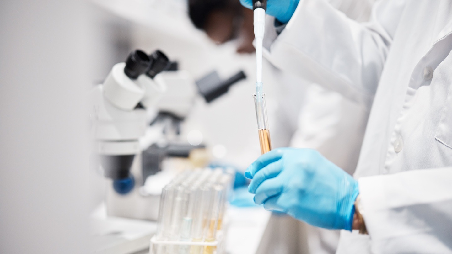 Inocras, AimedBio team up for cancer treatments
