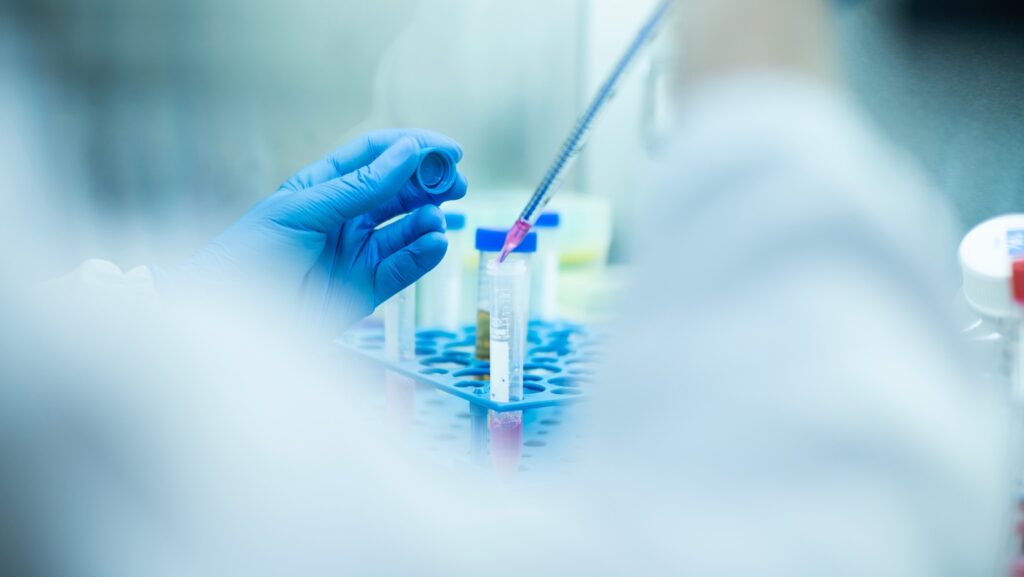 HBM7575/SKB575 blocks the interaction between TSLP and its receptor, inhibiting signalling pathways and Th2 immune cell activation. Credit: alicancomertpay / Shutterstock.com.