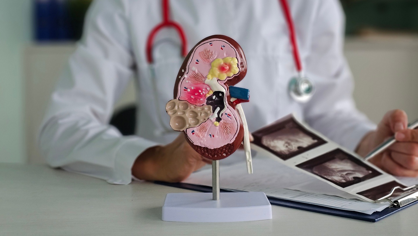 FDA grants traditional approval to Novartis’ Fabhalta for IgAN