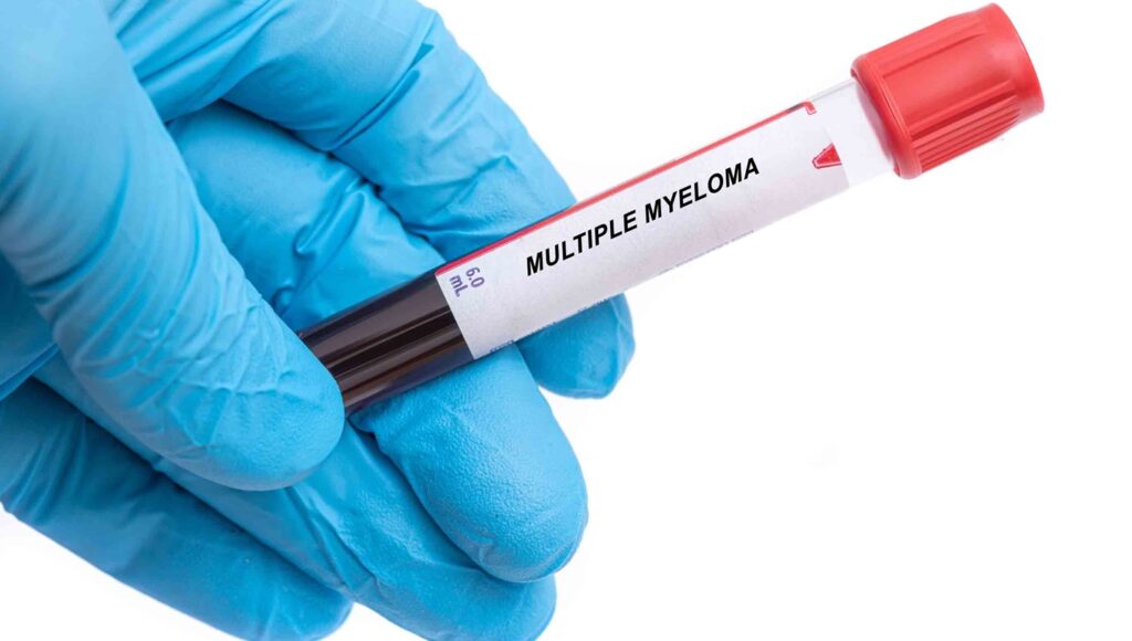 The decision provides a new therapeutic option for patients with r/r MM. Credit: luchschenF / Shutterstock.com.