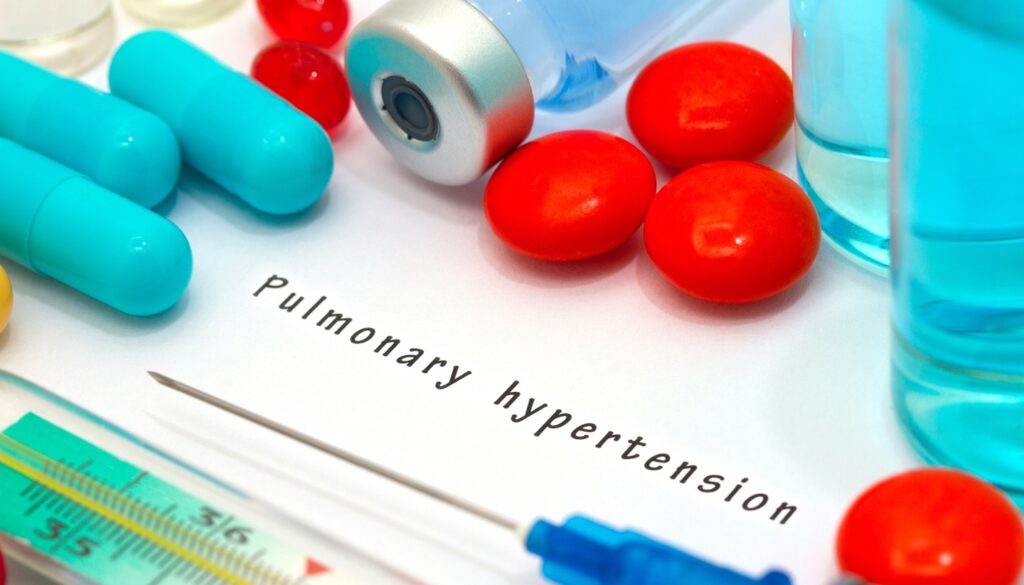 Seralutinib is intended for the treatment of pulmonary hypertension associated with interstitial lung disease and pulmonary arterial hypertension. Credit: Green Apple/Shutterstock.com.