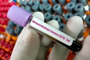 Lundbeck’s asedebart receives EC orphan designation in Cushing’s syndrome