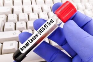 Jazz secures FDA approval for Ziihera in advanced HER2+ GEA