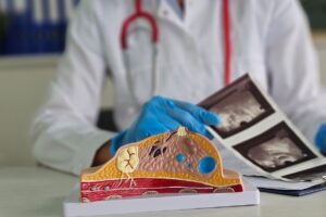 FDA approves AstraZeneca’s Etcamah combo for advanced breast cancer