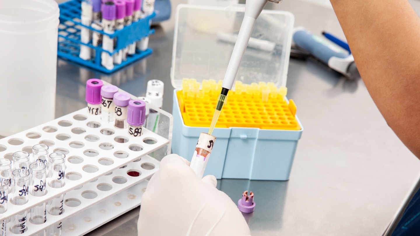 Biocytogen and Qilu Pharmaceutical sign agreement for VHH antibody molecule