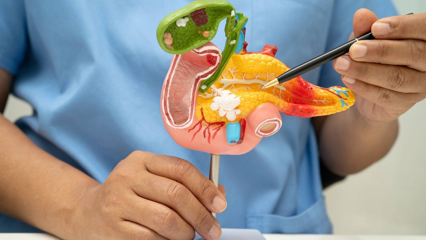 Genialis and Inventia to enhance pancreatic cancer treatment testing