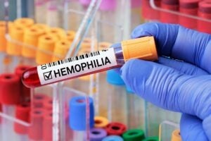 Sandoz and mAbxience agree on emicizumab biosimilar partnership