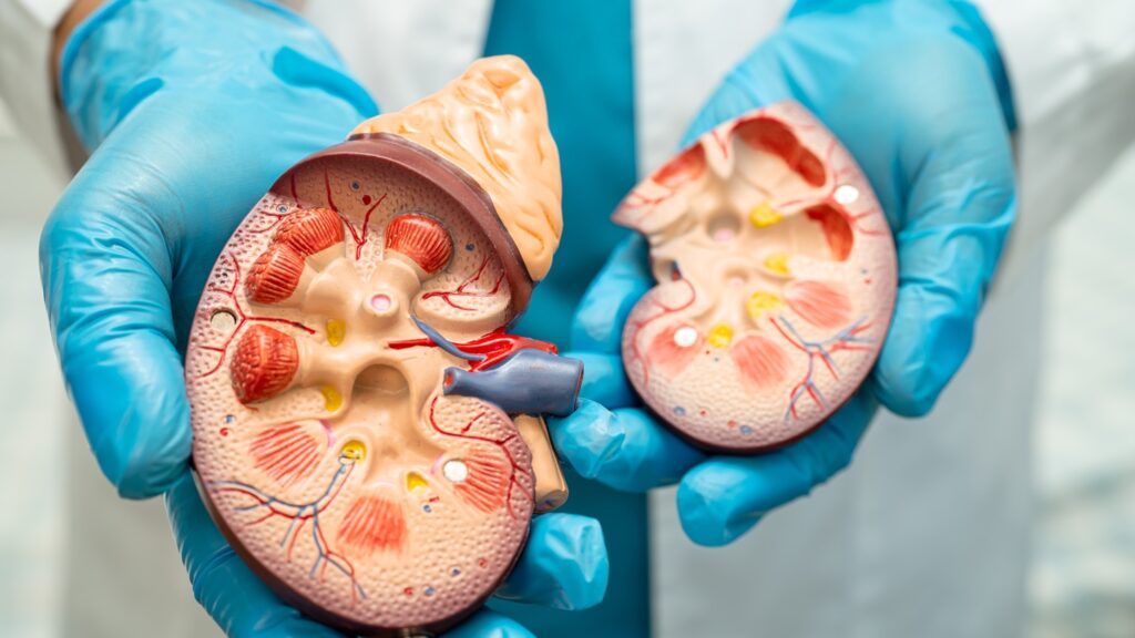 ADPKD is an inherited, progressive disorder where fluid-filled cysts expand in both kidneys. Credit: sasirin pamai/Shutterstock.com.