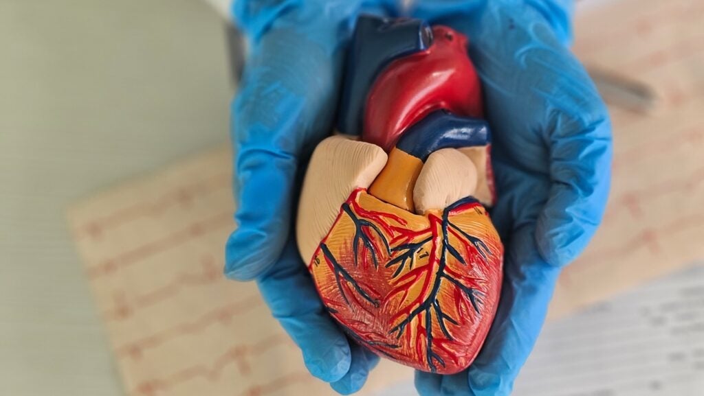 Medical,Professional,Holds,Detailed,Heart,Model,During,Health,Education,Session